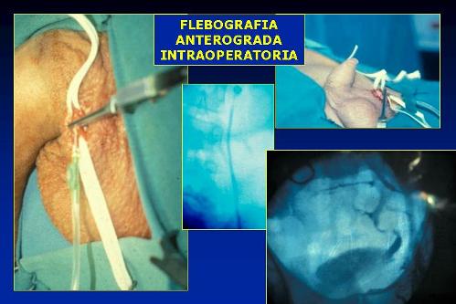 Quali esami sono necessari per diagnosticare l’infertilità maschile ? — Infertilità