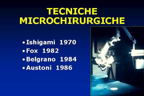 Microchirurgia del varicocele