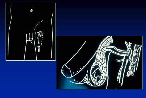Quali esami sono necessari per diagnosticare l’infertilità maschile ? — Infertilità