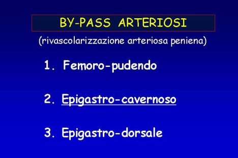 Arterializzazione vena dorsale profonda sec.virag 1-2-3- — Chirurgia vascolare del pene