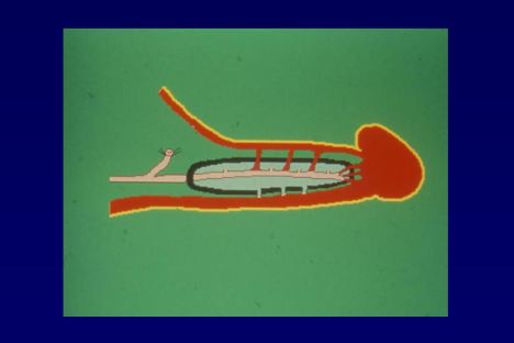 Chirurgia vascolare del pene — figura 24