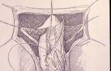 Riparazione in tempo unico — Malformazioni congenite