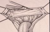 Riparazione in tempo unico — Malformazioni congenite