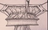 Riparazione in tempo unico — Malformazioni congenite