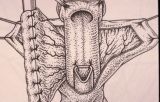 Riparazione in tempo unico — Malformazioni congenite