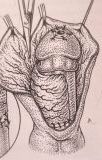 Riparazione in tempo unico — Malformazioni congenite