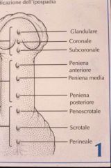 Micropene — Malformazioni congenite
