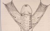 Riparazione in tempo unico — Malformazioni congenite