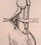 Riparazione in tempo unico — Malformazioni congenite
