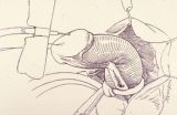 Riparazione in tempo unico — Malformazioni congenite