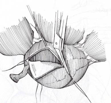 Bibliografia — Plastiche della GPU
