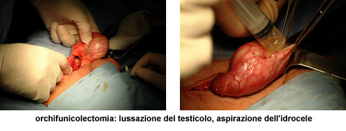 Terapia del tumore del testicolo — figura 3