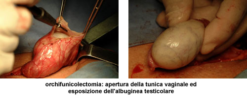 Terapia del tumore del testicolo — figura 4