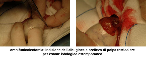 Terapia del tumore del testicolo — figura 5