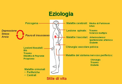 Quali sono le cause principali della D.E. ? — Disfunzione erettile
