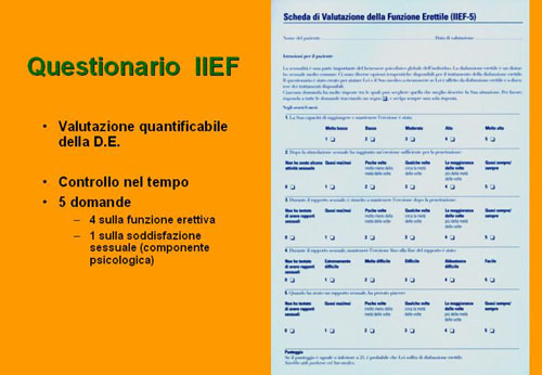 Quali esami sono necessari per diagnosticare la D.E. ? — Disfunzione erettile