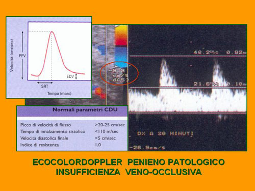 Quali esami sono necessari per diagnosticare la D.E. ? — Disfunzione erettile