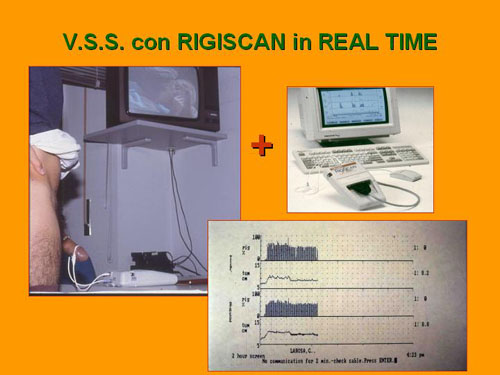 Quali esami sono necessari per diagnosticare la D.E. ? — Disfunzione erettile