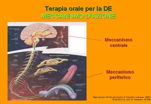 Quali possibilità di cura esistono oggi per la D.E. ? — Disfunzione erettile