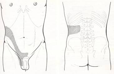 Clinica — Calcolosi