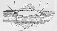 Diagnosi precoce del tumore della vescica — figura 9