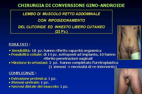 la clitoridopessia alla base del neo pene (sec.Austoni 1990) — Disturbi di Genere