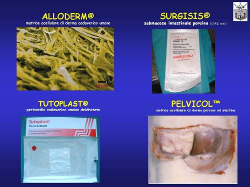 Falloplastica — figura 3