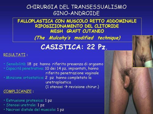 (Clitoridofallopessia sec.Austoni) — Falloplastica