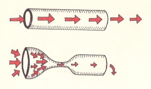 Stenosi uretrali — figura 12