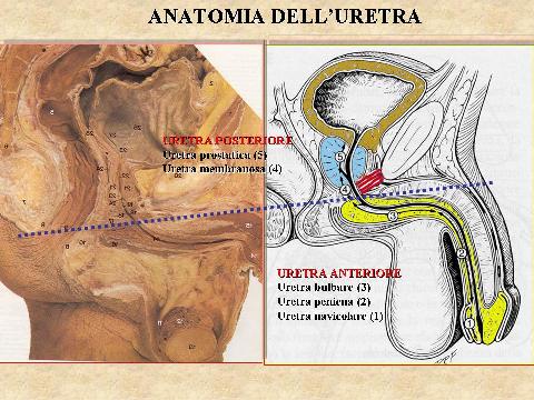CHE COS'È L'URETRA E DOVE SI TROVA — Stenosi uretrali