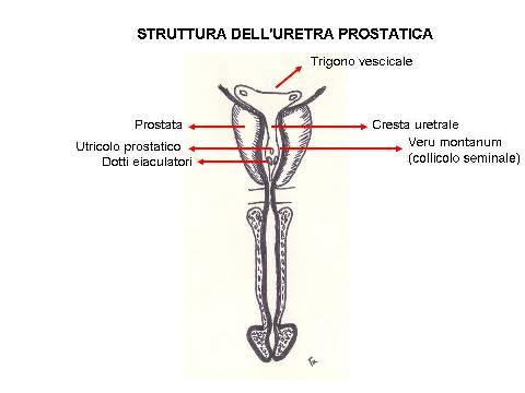 POSTERIORE: Membranosa, Prostatica — Stenosi uretrali