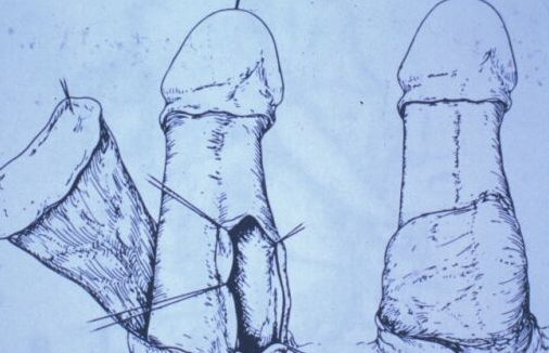 Segreteria — Malformazioni congenite