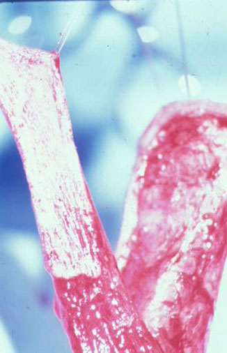 Segreteria — Malformazioni congenite