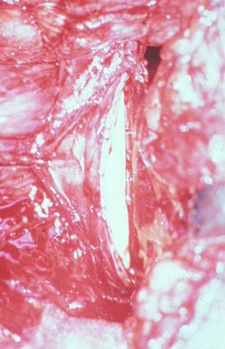 Segreteria — Malformazioni congenite