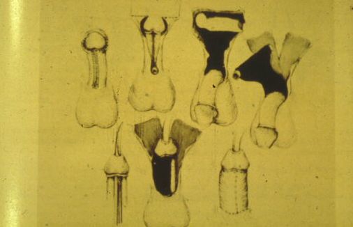 Segreteria — Malformazioni congenite