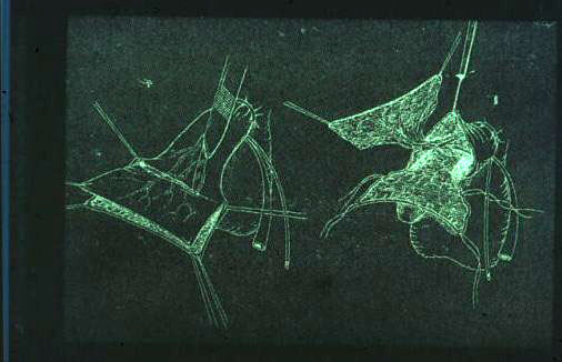 Micropene — Malformazioni congenite