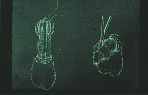 Segreteria — Malformazioni congenite