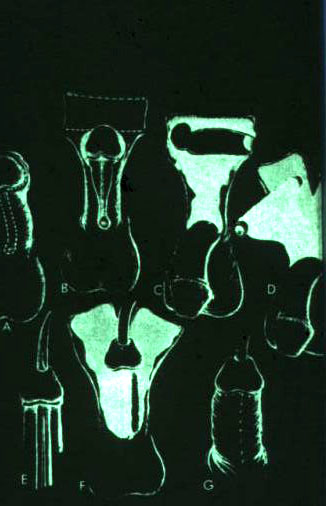 Segreteria — Malformazioni congenite