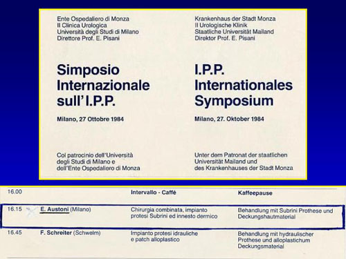 Asportazione completa della placca + innesti liberi o vascolarizzati — Pene Curvo – Malattia di La Peyronie
