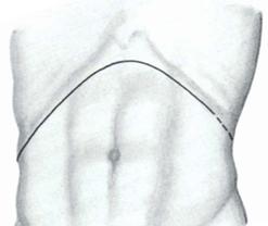 La procedura chirurgica standard in caso di sospetto tumore del rene è la — Terapia del tumore del rene