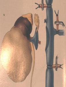Terapia del tumore del rene — figura 23
