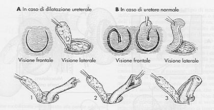 Terapia del tumore della vescica — figura 29