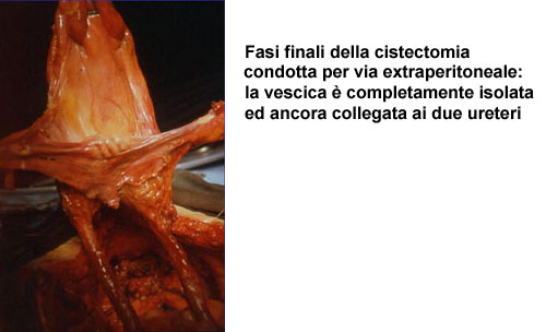 Terapia del tumore della vescica — figura 30