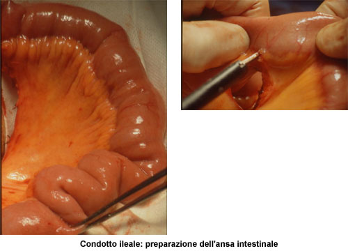 Terapia del tumore della vescica — figura 24