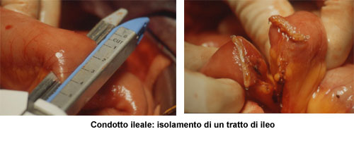 Terapia del tumore della vescica — figura 25