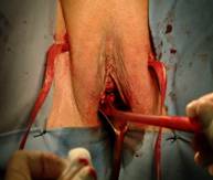 Urodinamica — figura 18