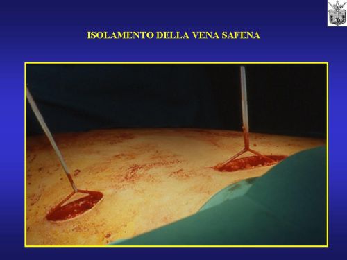 Micropene — Malformazioni congenite