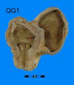 Vescica — figura 5