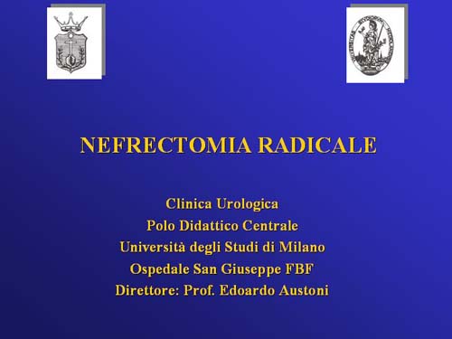 Terapia del tumore del rene — figura 18
