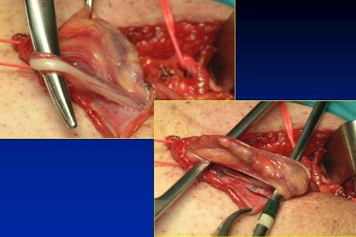 Quali esami sono necessari per diagnosticare l’infertilità maschile ? — Infertilità